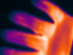Thermografie